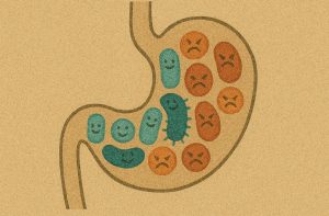 Gut Health Imbalance and Dysbiosis