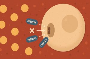 1. Insulin Resistance and Glucose Imbalance